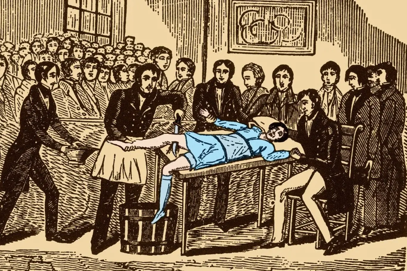 Chirurgický zákrok před vynálezem anestetik