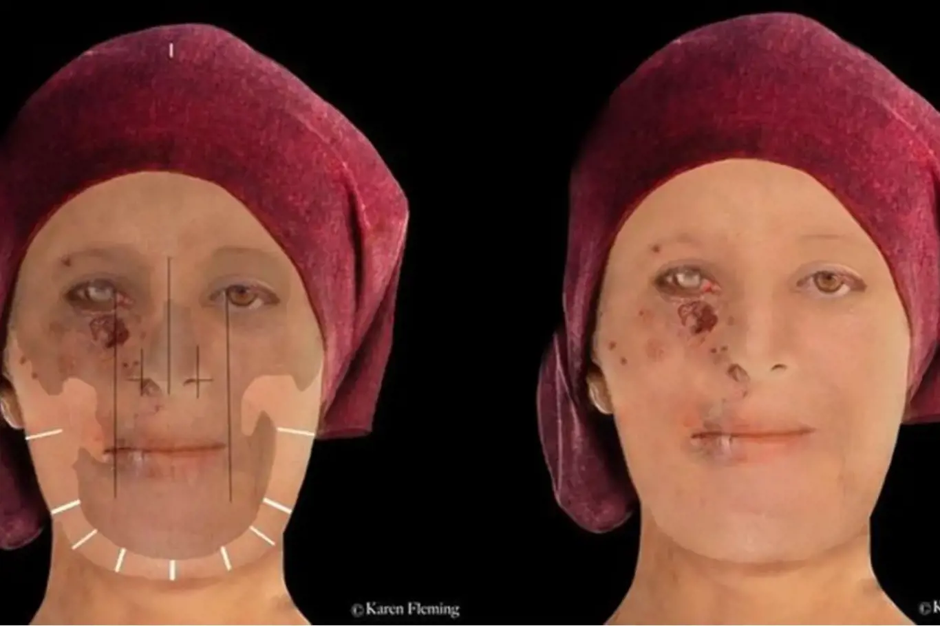 Forenzní rekonstrukce ženiny tváře
