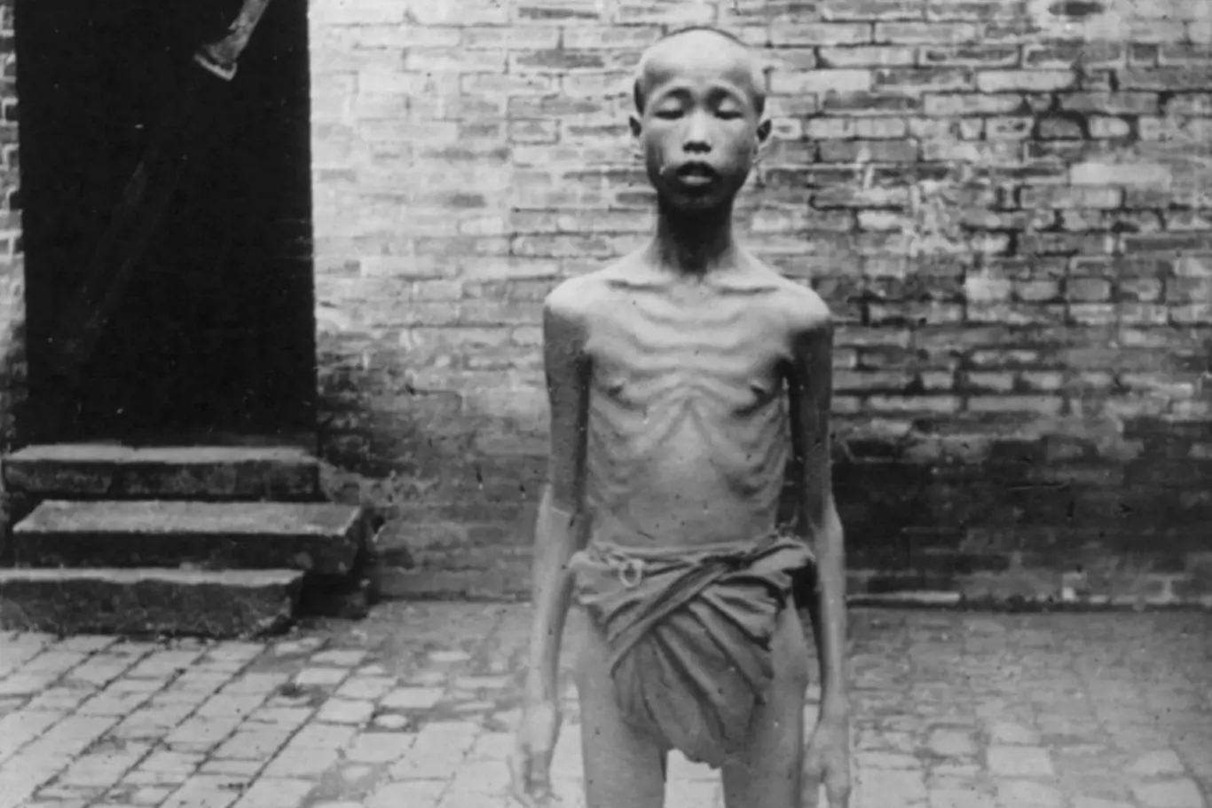 Jedna z obětí velkého čínského hladomoru.