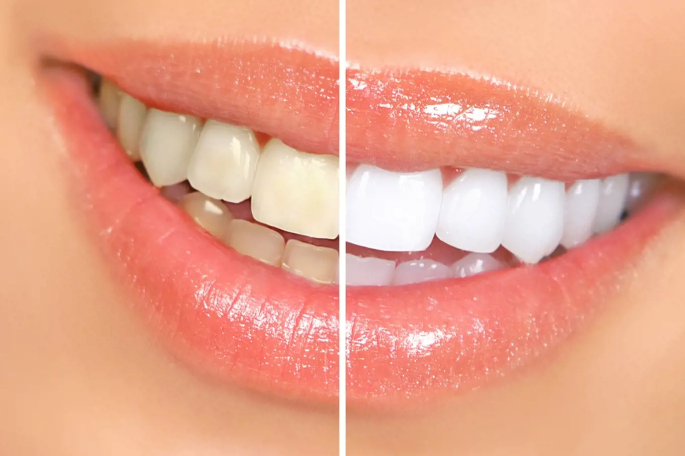 Bílé zuby působí zdravějším dojmem.