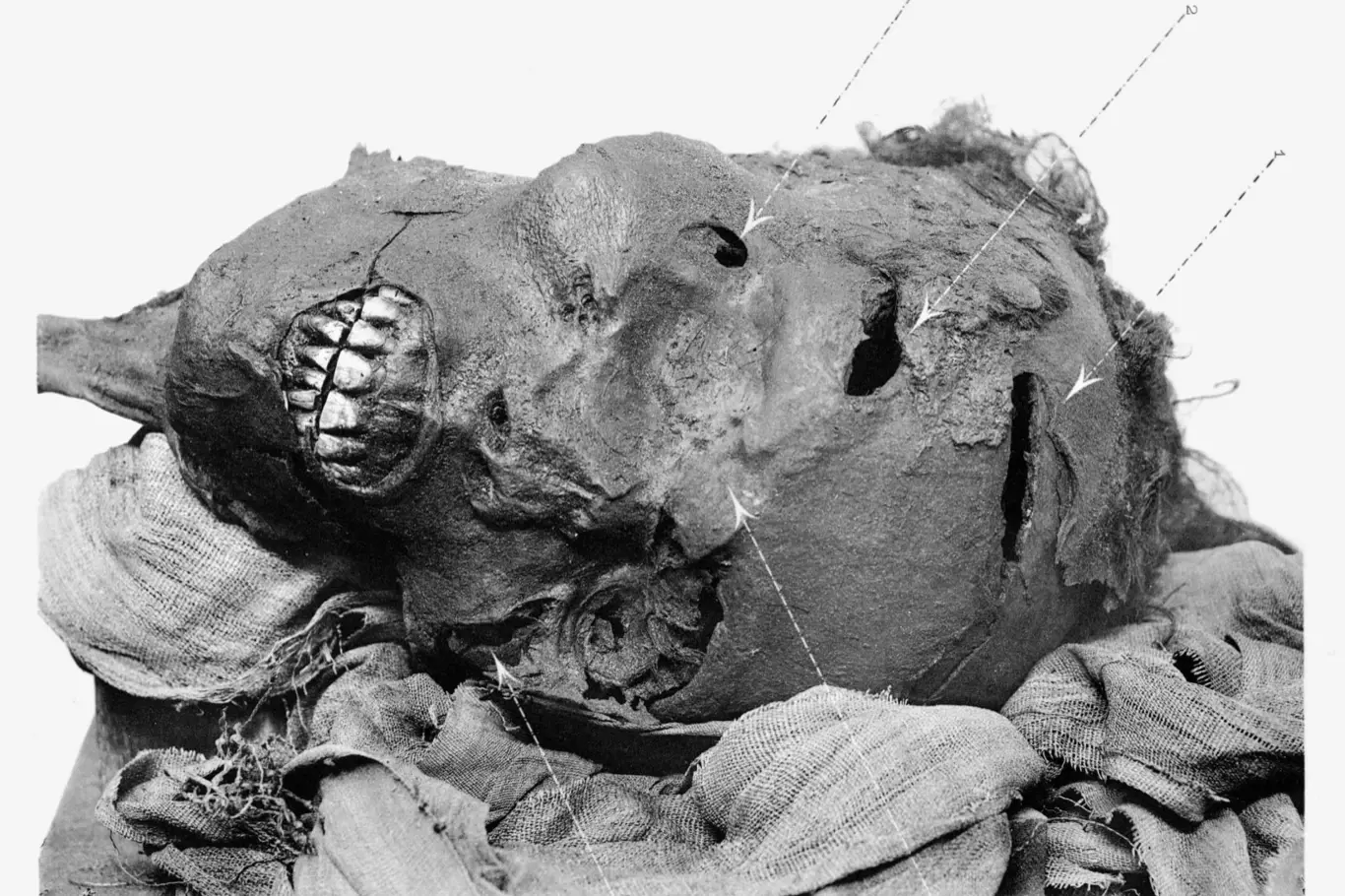 Mumifikovaná hlava Seqenenra s vyobrazením jeho zranění. Řez nad okem byl způsoben jinou zbraní, pravděpodobně nějakou dýkou. Podle rozšířené teorie zemřel v bitvě proti Hyksósům