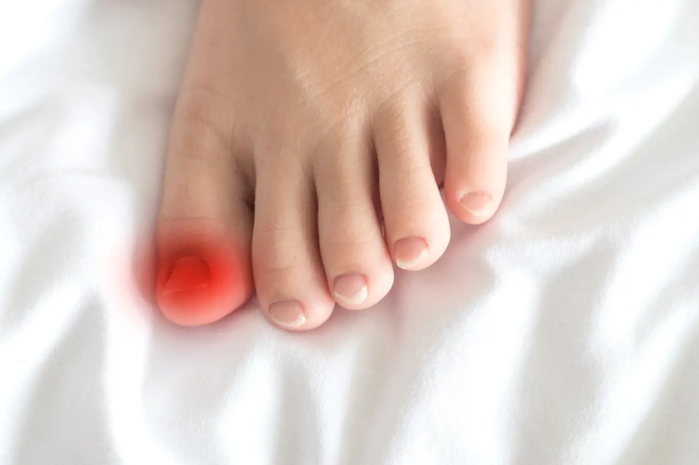 Zarostlé nehty umí pořádně potrápit a jedná se opravdu o velmi bolestivé stavy.