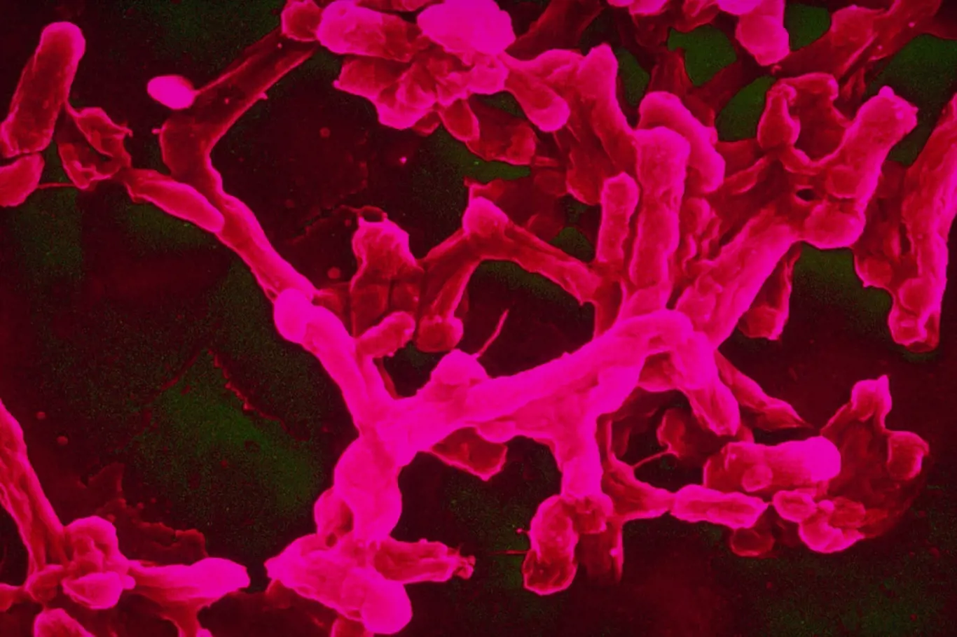 Původce břišního typu je bakterie Salmonella typhi (obrázek z elektronového mikroskopu).
