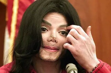 Michael Jackson měl totálně zničené nohy: Rozpadaly se mu zaživa!