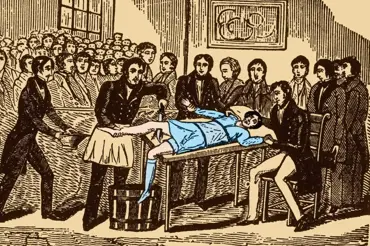 Jak probíhaly amputace nohou v 18. století: Chirurg Liston je zvládl za 2 minuty