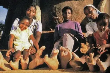 Pštrosí lidé: Na nohou mají jen dva obří prsty. Skvěle jich využívají, získali jimi evoluční výhodu