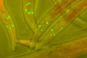 Vědcům se podařilo prodloužit život červů o 500 %. Může to fungovat i na lidi