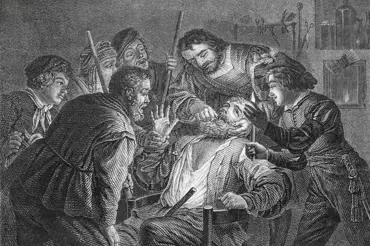 Jak vypadala návštěva u zubaře minulosti: Nejhorší zážitek to byl ve středověku