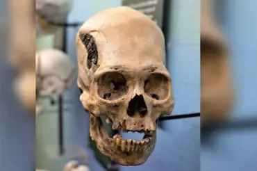 Vědce šokovala 2000 let stará lebka peruánského válečníka. Zcela mění historii moderní chirurgie