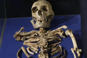 31 tisíc let stará kostra přepsala historii. Nový nález mění pohled na dějiny moderní chirurgie