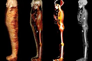 Vědci digitálně rozbalili mumii egyptského chlapce. V jeho těle našli ukrytý velký zlatý poklad