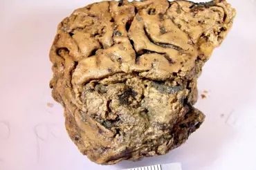 Vědci našli 2600 starý zcela zachovalý mozek. Může pomoci při léčbě Alzheimera