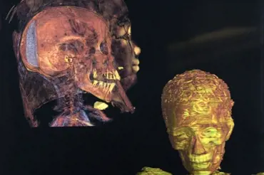 Vědci udělali CT sken mozku egyptské mumie a užasli. Objevili pozoruhodný předmět. Podívejte!