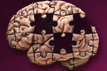 Jak rozpoznat počínající Alzheimerovu chorobu: První příznaky jsou nenápadné