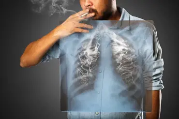 Plíce se po respirační nemoci samovolně obnoví. Kuřáci si škodí nevratně