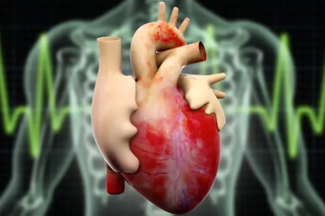 Jak poznat infarkt myokardu: příznaky jsou velmi různé, trvají více než 10 minut