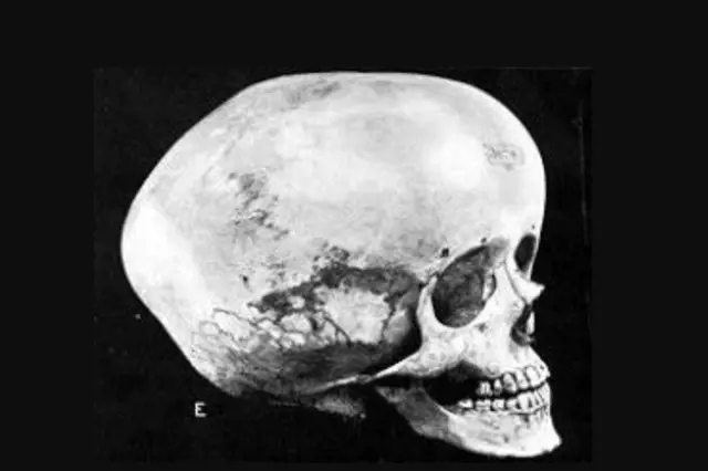 Velká lebka záhadného hominida zmátla vědecký svět. Boskopský muž měl nesrovnatelně vyšší IQ než my