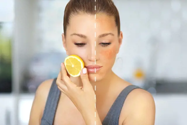 Jak odstranit stařecké pigmentové skvrny z obličeje účinně domácím elixírem