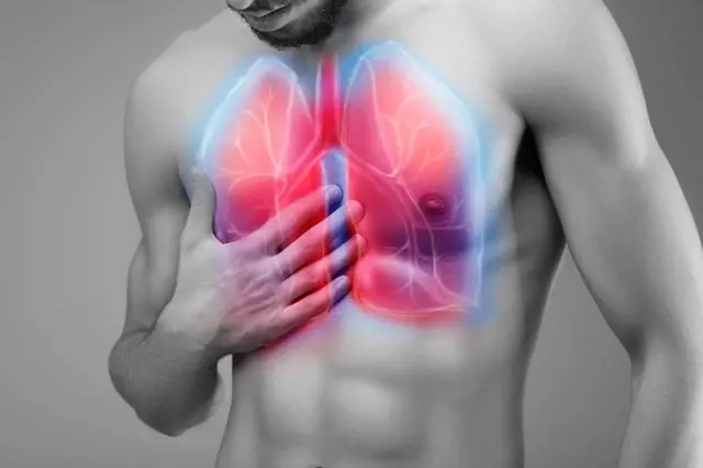 Jak rozpoznat počínající zápal plic, příznaky mohou být nenápadné