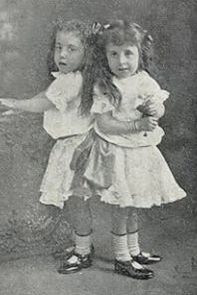 Daisy a Violet Hiltonovy