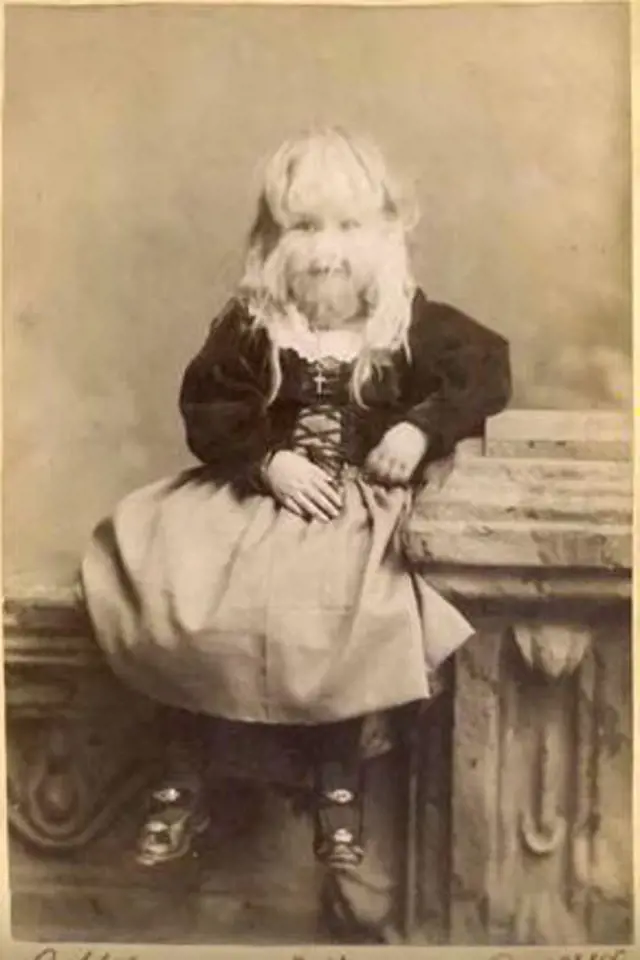 Alice vystupovala jako Dítě jehně od svých dvou let.