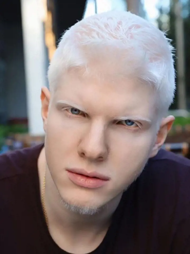 Albinismus byl dříve považován za něco nadpřirozeného.