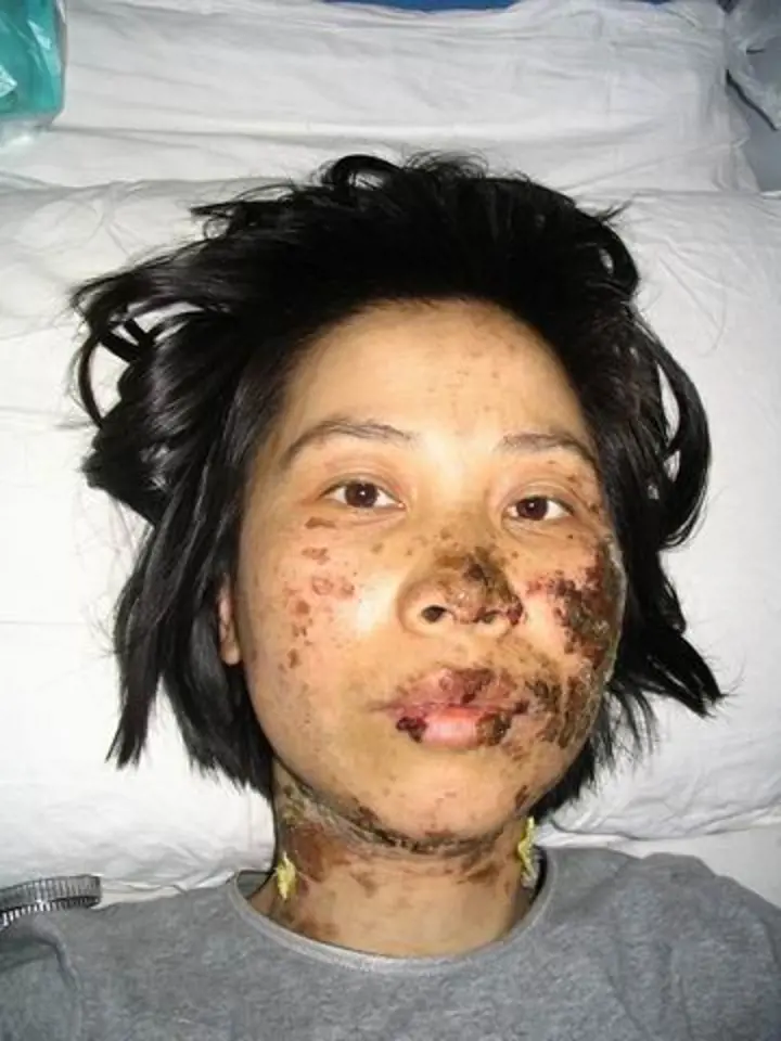 Gao Rongrong byla za praktikování Falun Gong mučena (2005).
