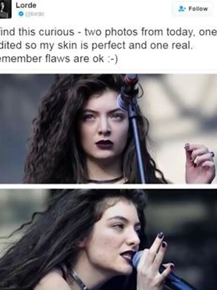 Lorde - Tuto zpěvačku rozesmál pohled na své fotografie. Ty byly pořízené na jejím koncertě v roce 2014. Ovšem jedna byla před uveřejněním upravena, druhá byla bez úprav. Lorde ke snímkům uvedla: "Mít nedostatky, je normální."