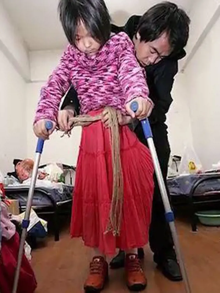 Qian Hongyan - Qian byly pouhé čtyři roky, když při autonehodě přišla o obě dolní končetiny. V deseti letech konečně dostala své první protézy. Dnes se mladá žena věnuje plavání a účastnila se i paralympiády.