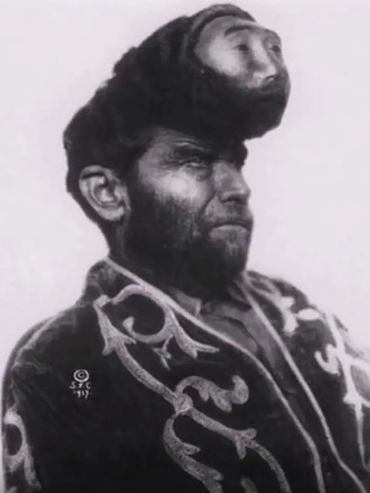 Pasqual Penon pocházel z Mexika a v cirkusu předváděl své dvě hlavy.