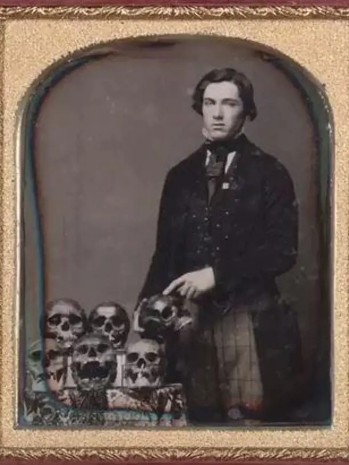 1850 - muž se svou sbírkou lebek