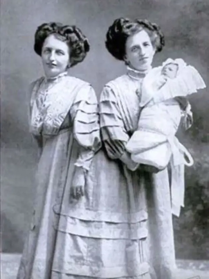Josefa a Rosa Blazeh - siamská dvojčata, jezdila s cirkusem po celém světě. Na snímku drží Rosa svého syna. Ženy se dožily 44 let.
