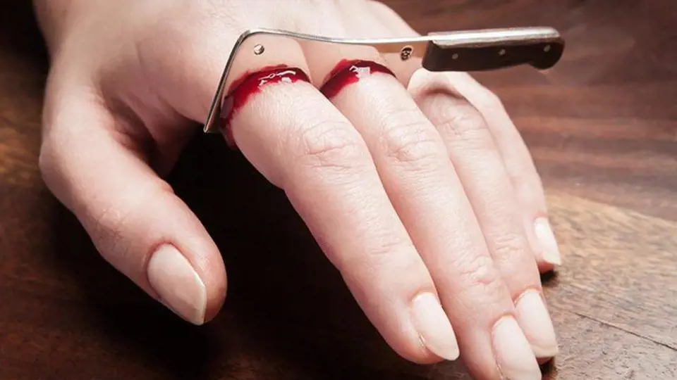 Nejděsivnější tresty, které mohla žena dostat za zapovězenou lásku - ilustrační foto - useknutí prstů