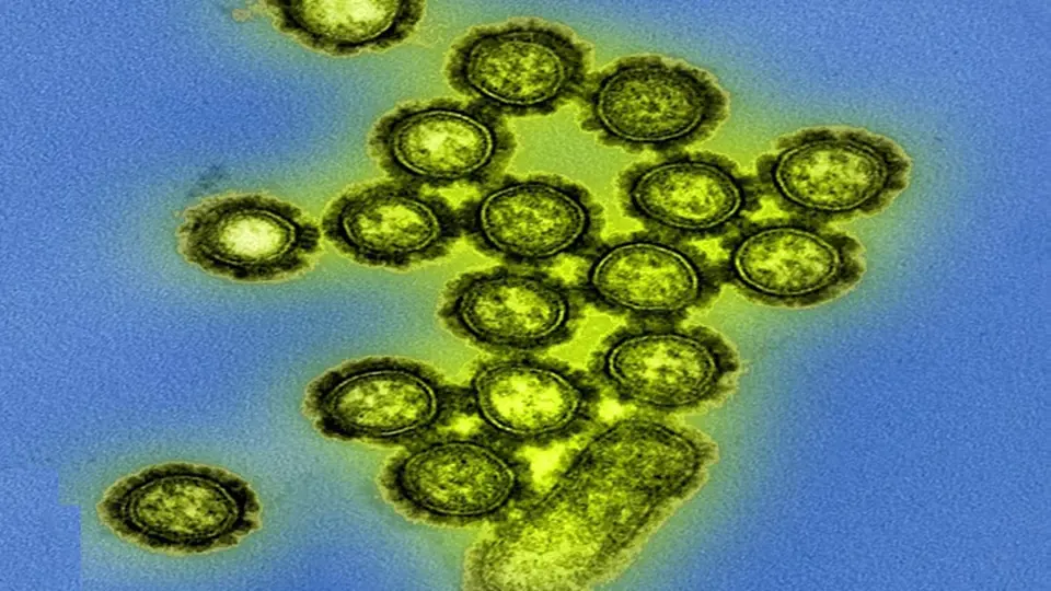 Virus H3N2