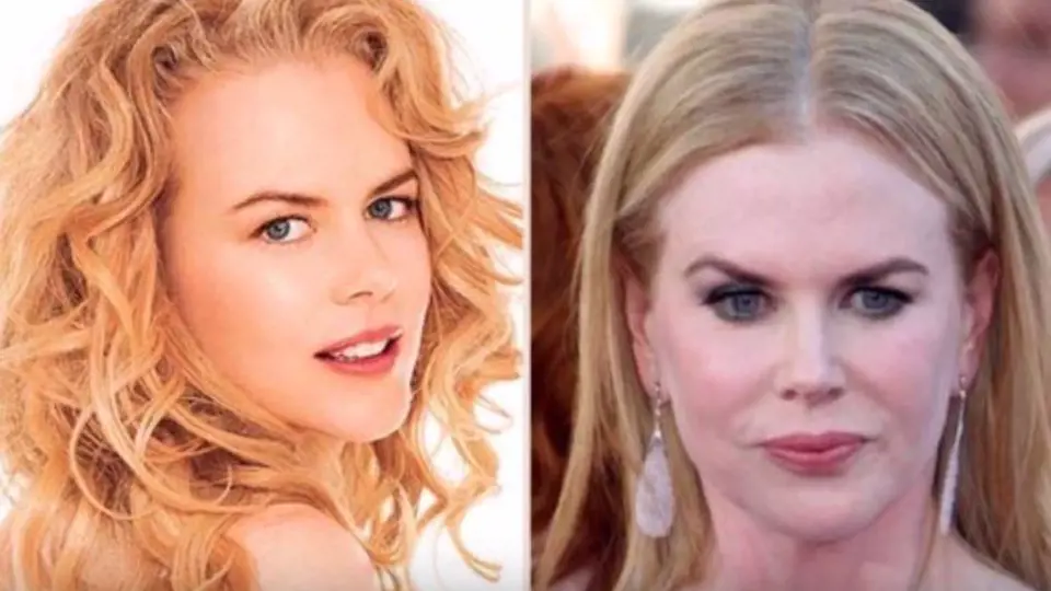 Nicole Kidman už nedostává role, kde by bylo potřeba ji zabrat velmi zblízka...