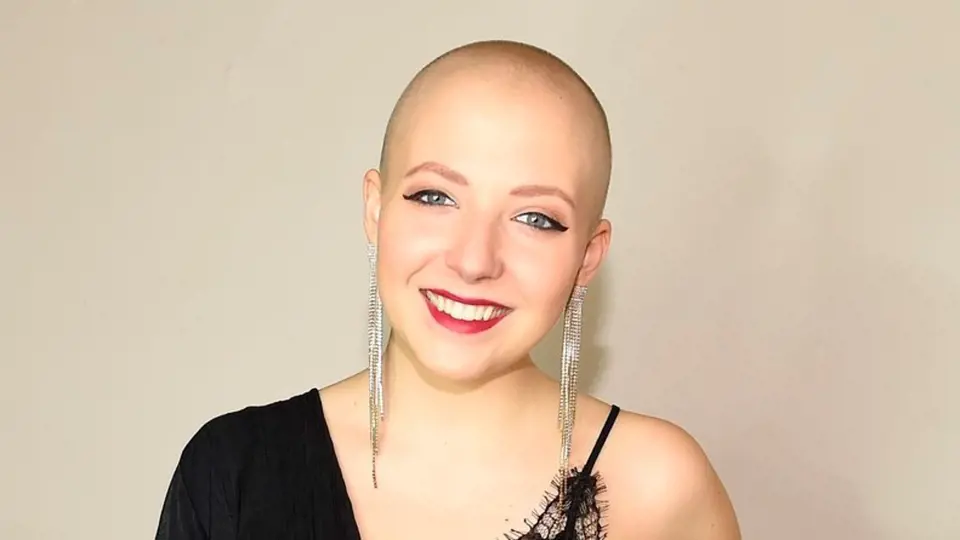 Anička Slováčková kvůli léčbě rakoviny prsu přišla o vlasy.