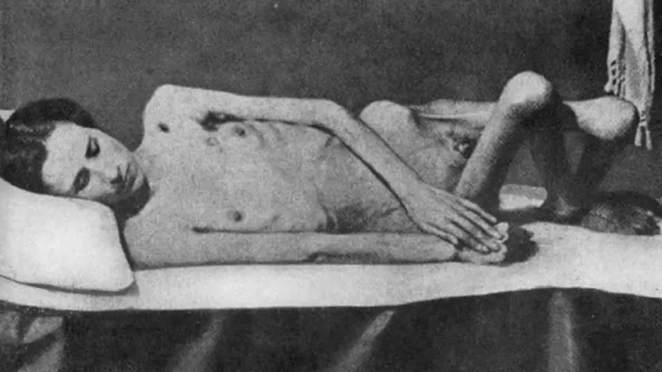 Vězeňkyně z Ravenbrücku vyhublá na kost. Z celkového počtu 132 000 žen a dětí, které prošly Ravensbrückem, zahynulo 92 000 obětí.