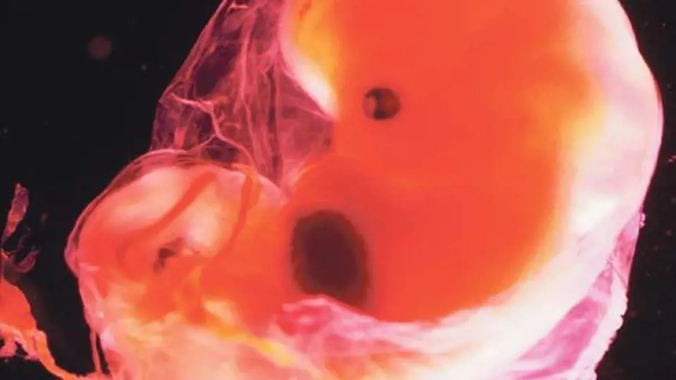 Lidské embryo v 15. týdnu těhotenství
