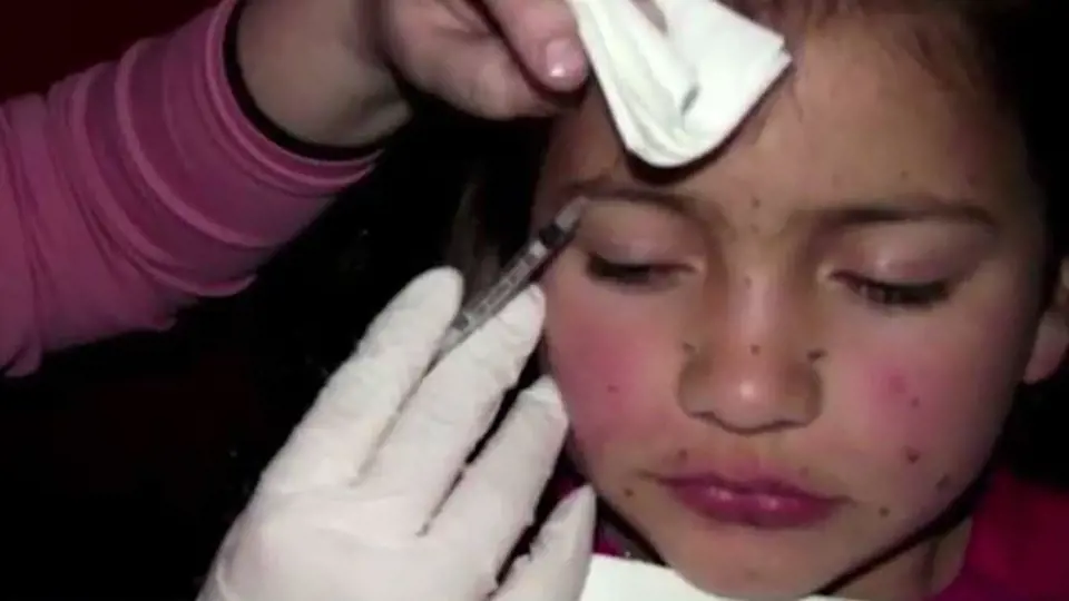 Botox je už opravdu extrém. Této dívence jej aplikuje od jejích osmi let matka.
