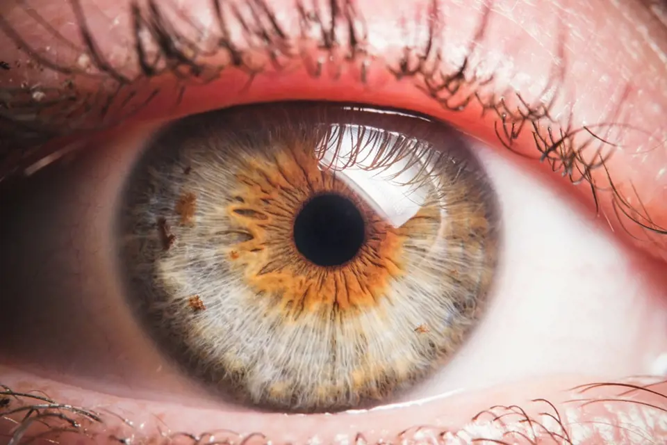 Oční duhovka mívá různé zbarvení.