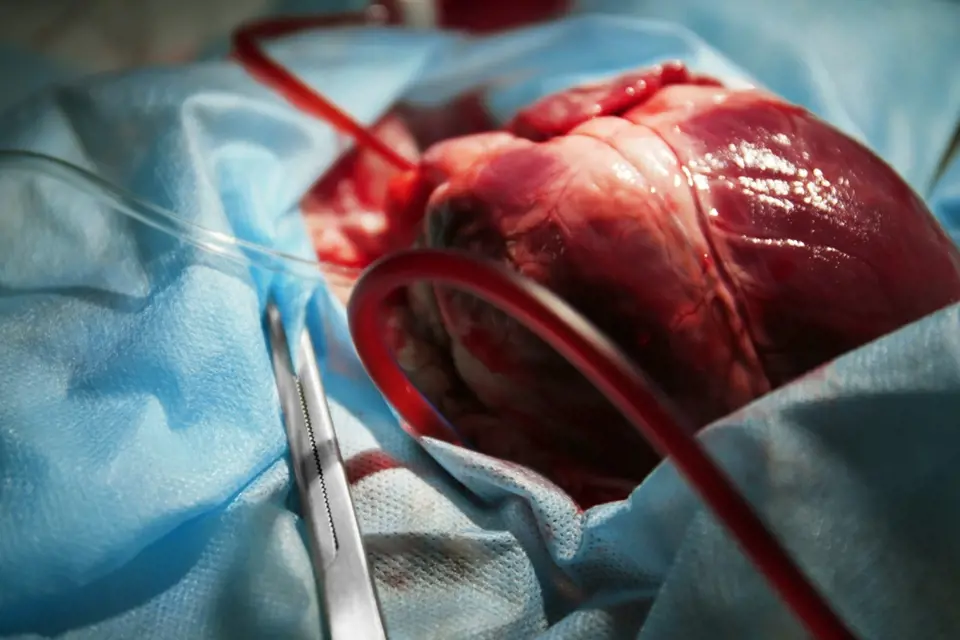 Barnard, inspirován Děmichovem, provedl první transplantaci srdce na světě.