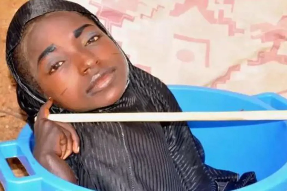 Rahma Haruna (19): Nemá ruce ani nohy a žije v plastovém lavoru