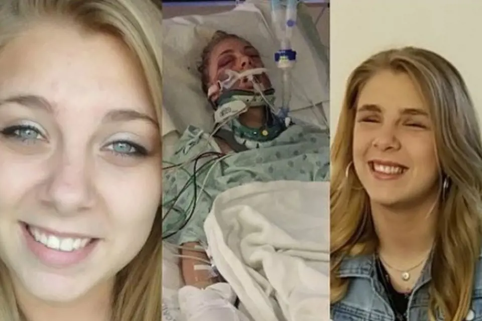 Kaylee byla po oslepení sebe sama několik týdnů v nemocnici.