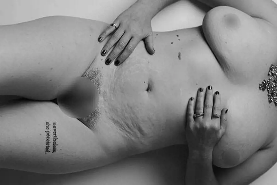 Reálné fotky matek, které se za proměnu svého těla nestydí
