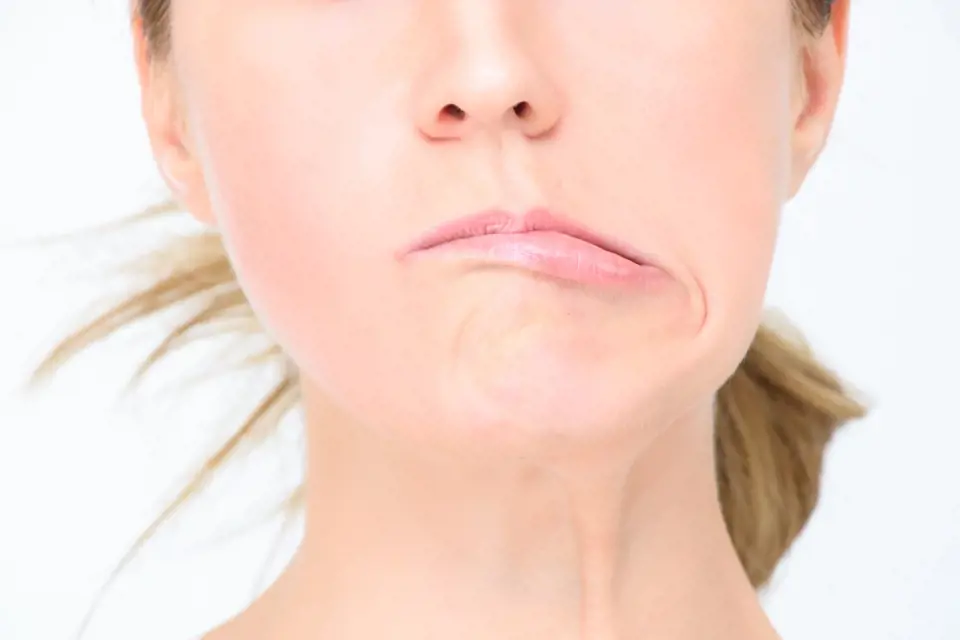 Povislé koutky souvisí s ochrnutím a ztrátou citlivosti obličeje (zpravidla jen jedné poloviny).