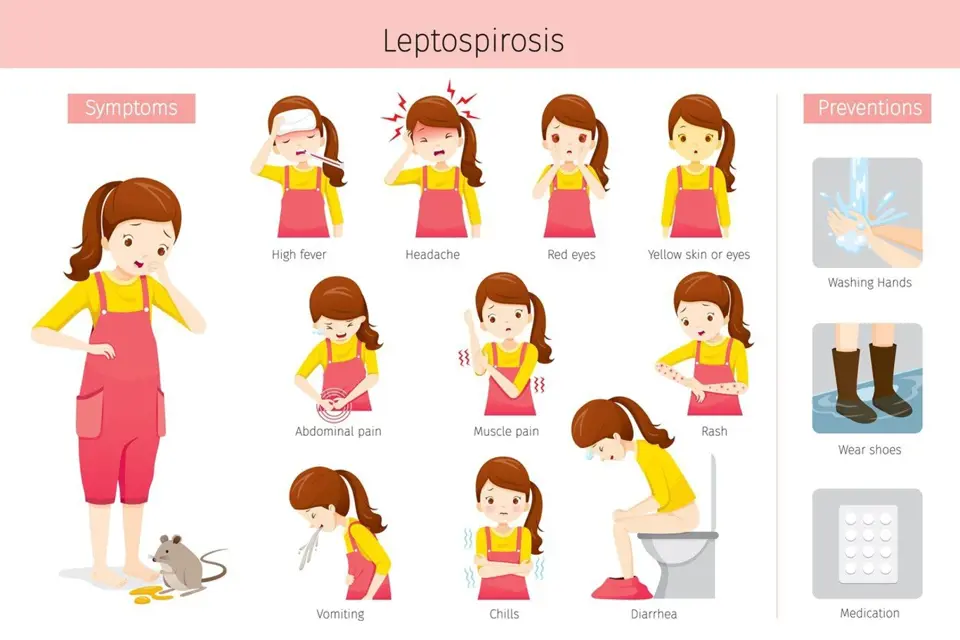Přehledná tabulka příznaků, které provádí leptospirózu.