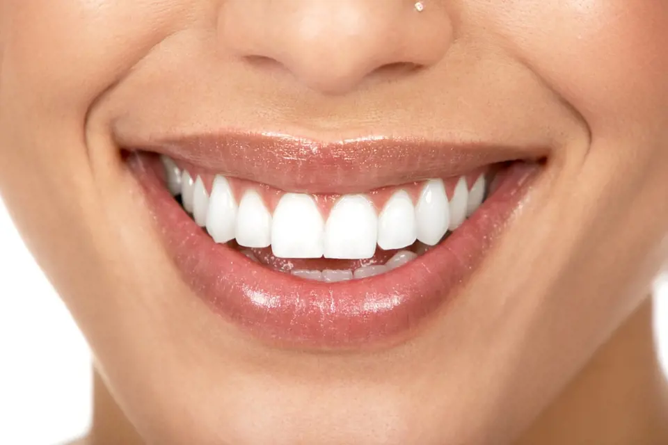Zářivě bílé zuby jsou pro někoho nedostižnou metou.