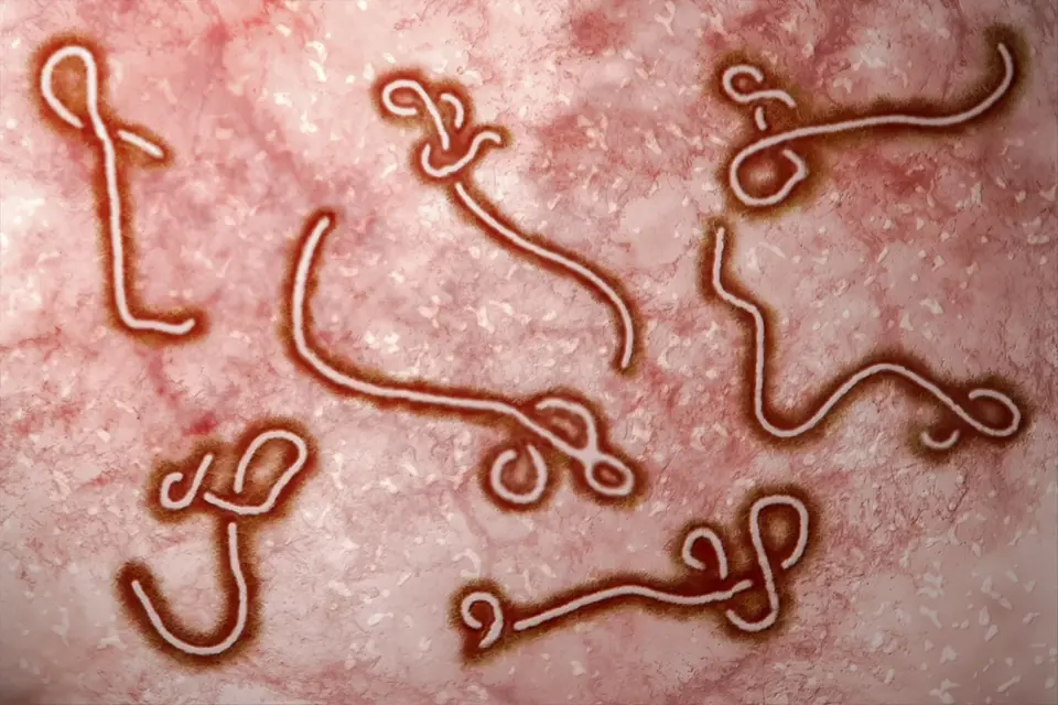 Vědci se domnívají, že šlo o krvácivou horečku podobnou ebole.