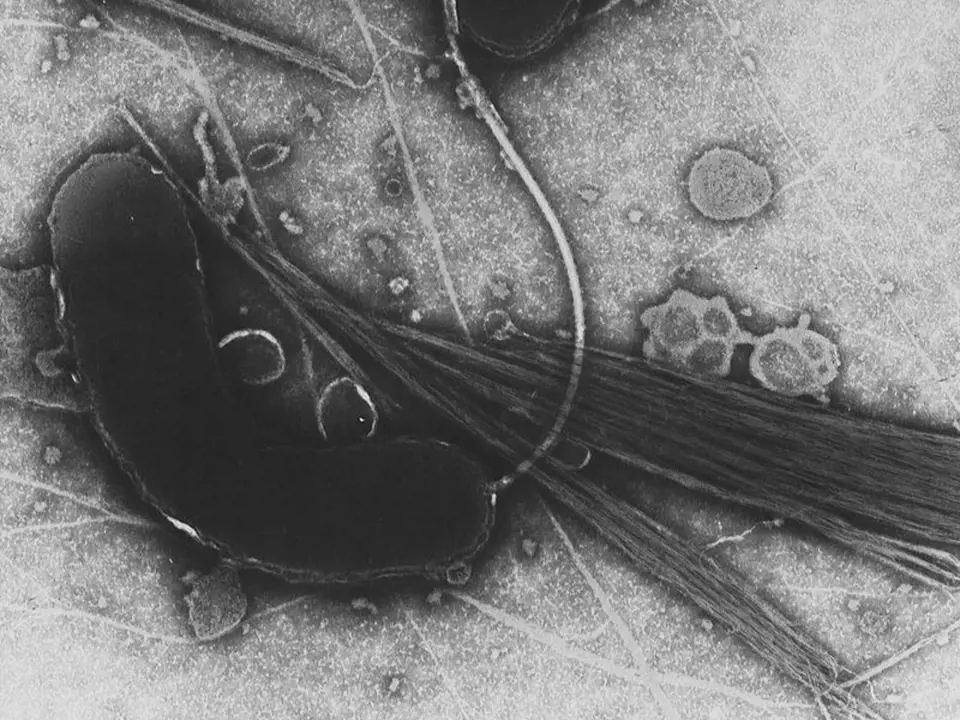 Bakterie Vibrio cholerae