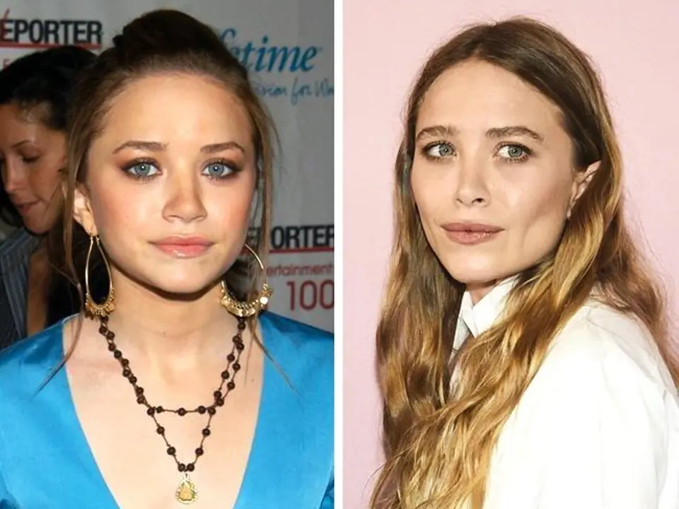 Mary-Kate Olsen, 31: Dříve bylo těžké dvojčata Olsenovy od sebe rozeznat. Mary-Kate má ale za sebou tolik zákroků, že dnes vypadá úplně jinak než její sestra Ashley. Nechala si zúžit nos, upravit tvar rtů a také dolní čelisti.